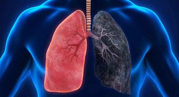 pulmão fumante